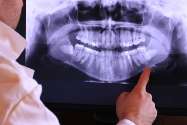 Best Emergency Tooth Extraction in Hayesville, OR